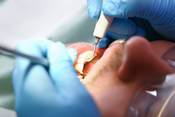 Best Emergency Dental Care for Sports Injuries in Terra Bella, CA